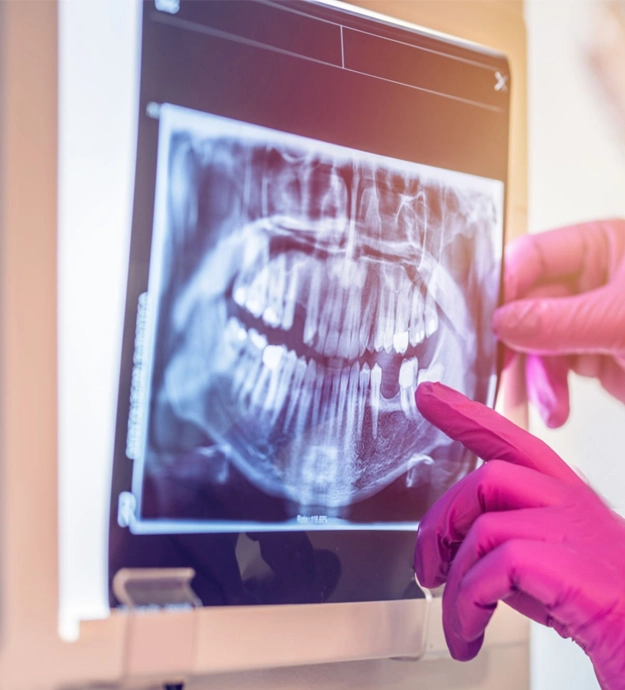 dental x-rays yorba linda